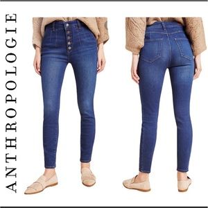 Pilcro button fly jeans